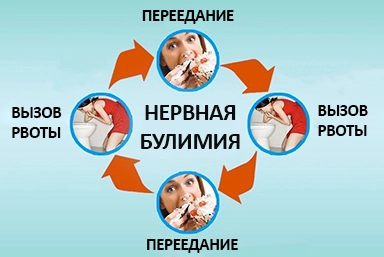 Лечение булимии в Мокшане